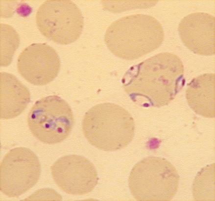 PLASMODIUM FALCIPARUM v