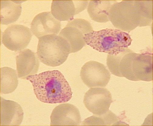 PLASMODIUM OVALE v periferní