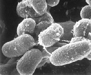 Mycobacterium avium subsp.