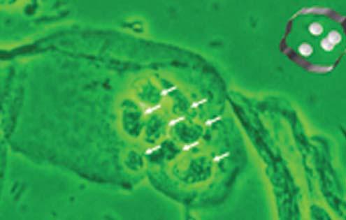 Ve zralém metaplastickém nebo originálním dlaždicovém epitelu jsou totiž tyto aktivní bazální buňky překryty vrstvou superficiálních deskvamujících buněk a pod nimi vrstvou buněk suprabazálních.