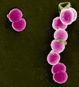 http://www.waterscan.co.yu Určitě tušíte, kdo je viníkem Samozřejmě, je to Neiserria gonorrhoeae, (gonokok) původce kapavky.