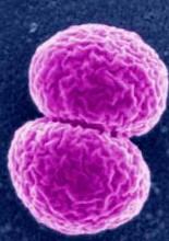 http://www.waterscan.co.yu A tímto viníkem je Neisseria meningitidis neboli meningokok Meningokok způsobuje meningitidy, ale i sepse a jiné závaţné stavy; to vše se týká tzv. klonálních kmenů.