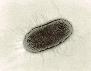 Kdo za to tentokrát můţe? www.steve.gb.com Viníkem je Escherichia coli, respektive její uropatogenní kmen (uropatogenní E.
