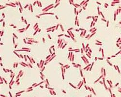 si E. coli