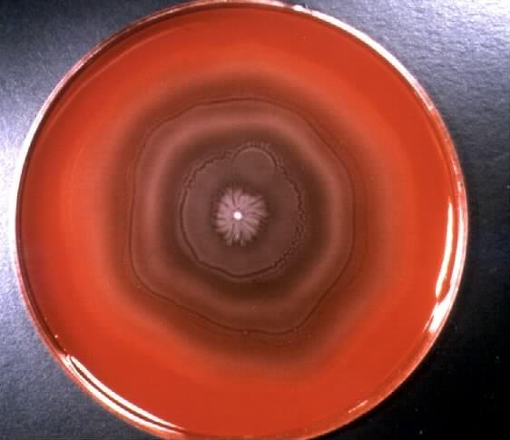 Proteus mirabilis, P.