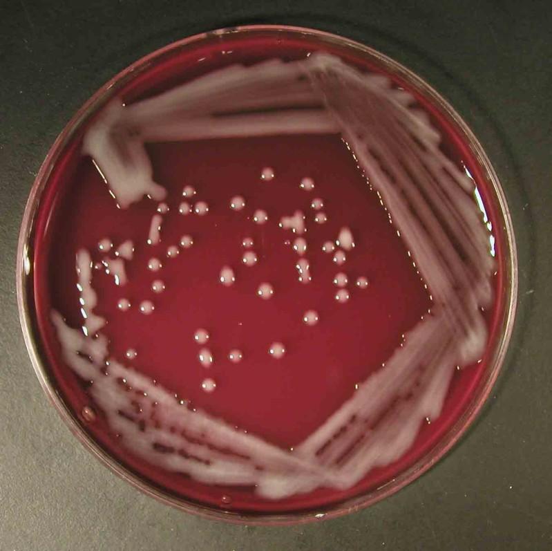 Klebsiely a escherichie www.medmicro.