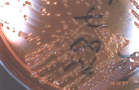 Burkholderia pseudomallei Burkholderia pseudomallei je původcem mellioidózy.