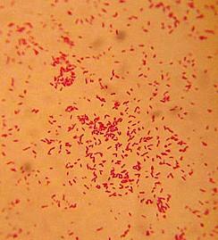Stenotrophomonas maltophilia http://www.scielo.
