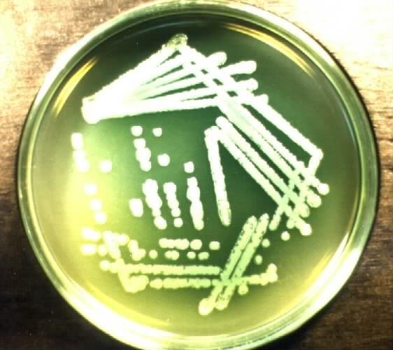Pseudomonas aeruginosa www.medmicro.