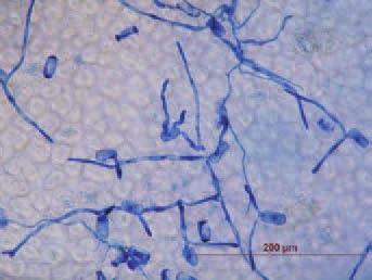 Jako reakci na pokus o proniknutí patogena do buňky ukládá rostlina sekundární metabolity (kalosu, křemík, vápník a fenolické sloučeniny) v papile mezi primárním klíčním vláknem a apresoriálními