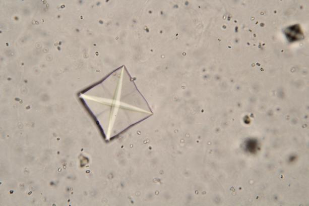 ), větší diagnostický význam mají však při otravě ethylenglykolem, při které dochází k toxickému poškození ledvin [4].