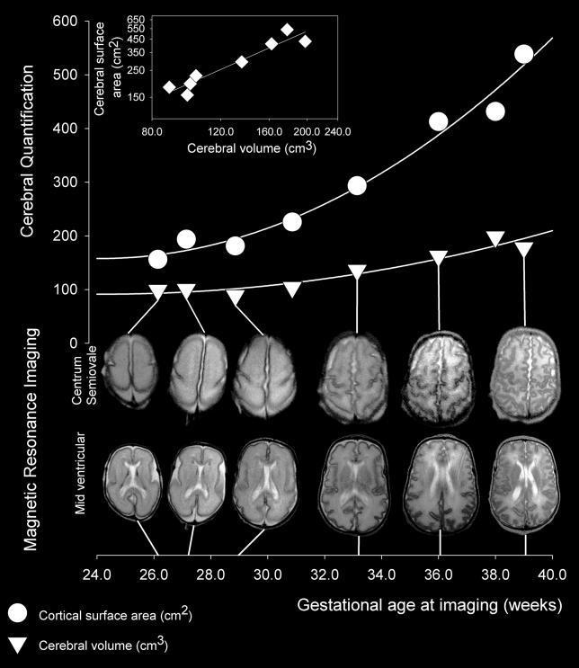 CNS -