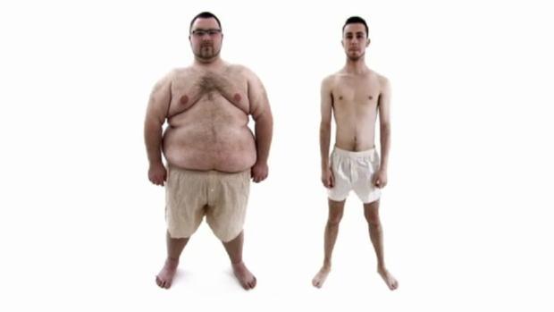 Nitrobřišní onemocnění Intraabdominální tlak (IAP), abdominální kompartment syndrom norma: 5 7 mmhg hodnota závislá : poloze BMI nárůstu objemu IAH: IAP 12 mmhg I. st.: 12 15 mmhg II. st.: 16 20 mmhg III.