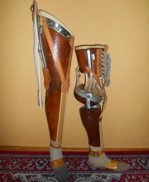 Na fotografii je vlevo (výroba protéz asi v r. 1985) exoskeletální protéza pro stehenní amputaci, vpravo pro amputaci bércovou s tzv. klečkou pro zachovalý kolenní kloub.