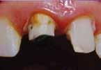 Kompletní praktický kurz ENDODONTICKÉ OŠETŘENÍ OD A DO Z Kompletní moderní