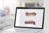 Lékař a dentální hygienistka, možnosti tvořivé spolupráce = spokojený pacient. CAD/CAM ve stomatologii, moderní pojetí stomatologie.