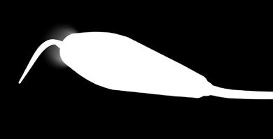 moderní ultrazvukové technologie v endodoncii Synchronizace lékař a dentální hygienistka, možnosti tvořivé spolupráce = spokojený pacient Využití dentální hygienistky