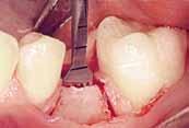 # speciální příloha Kompletní praktický kurz PRAKTICKÝ KURZ - LIVE OPERACE: SINUS LIFT, BONE SPLITTING A POUŽITÍ CBCT V PRAXI DATUM: Sobota 27.10.2018 od 9:00 hod.