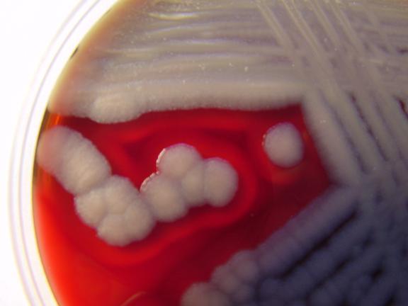 Presumptivní Bacillus cereus ČSN EN ISO 7932 Mikrobiologie potravin a krmiv - Horizontální metoda stanovení počtu presumptivního Bacillus cereus - Technika počítání kolonií vykultivovaných při 30 C K