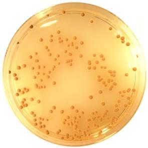 Kvasinky a plísně ČSN ISO 21527-1 (560650) Mikrobiologie potravin a krmiv - Horizontální metoda stanovení počtu kvasinek a plísní - Část 1: Technika počítání kolonií u výrobků s aktivitou vody vyšší