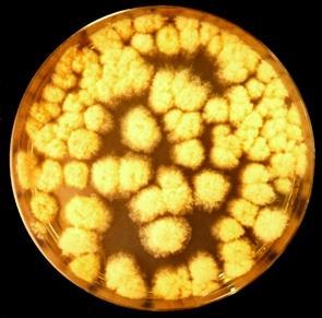 nižší nebo rovnou 0,95 =DG18 agar (agar s dichloranem a glycerolem) Složení (g/l) Živiny: Pepton 5.0; glukóza 10.0; Pufrovací systém: dihydrogenfosforečnan draselný 1.