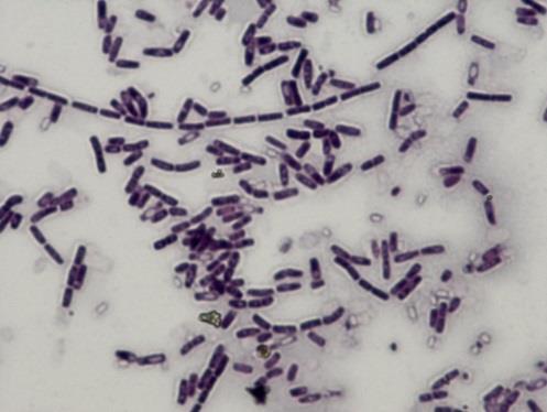 IDENTIFIKACE MIKROORGANISMŮ Identifikace na základě fenotypu: Fyziologické + biochemické znaky a) morfologie kolonie a buňky (Gramovo barvení, tvar) b) požadavky na teplotu, atmosféru, živné látky c)