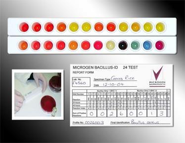 Bacillus cereus G+ tyčka tvořící endospóry, vlhké, snadno rostoucí kolonie při 37 C kataláza pozitivní, β-hemolýza, nefermentuje manitol + enzym lecitináza: roste v růžových koloniích se zónou