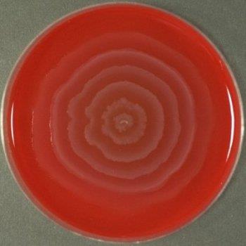 Rod Proteus Bakterie rodu Proteus (čeleď Enterobacteriaceae) typický plazivý růst příbojové vlny Raussův fenomén Plazivost je inhibována přídavkem deoxycholát sodného