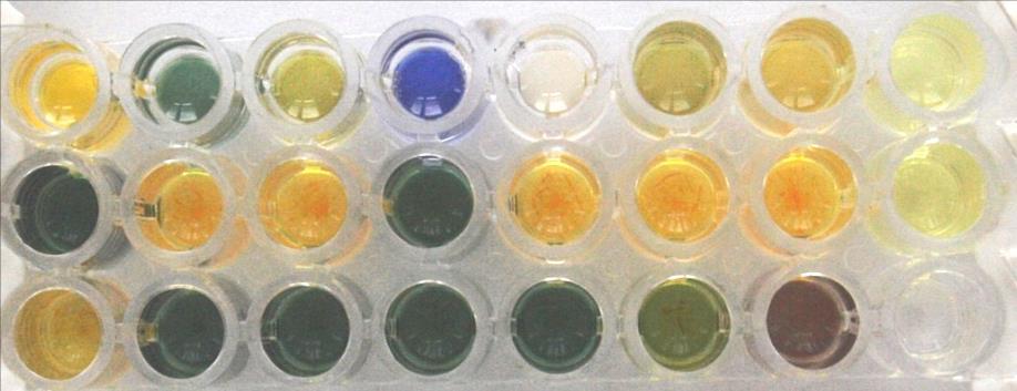 ENTEROtest 24 N Escherichia coli Výsledkem biochemické identifikace je soubor biochemických vlastností, který je srovnán s databází vlastností