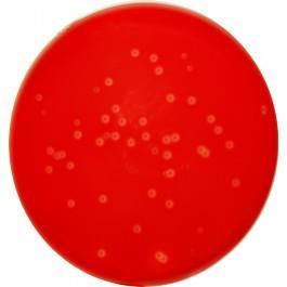 Escherichia coli