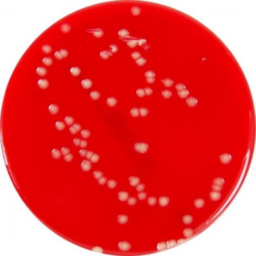 pyogenes http://www.