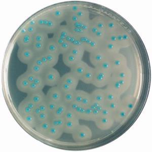 ALOA agar L. monocytogenes ALOA agar (agar pro listerie podle Ottavianiho a Agostiho) Růst Vzhled L.