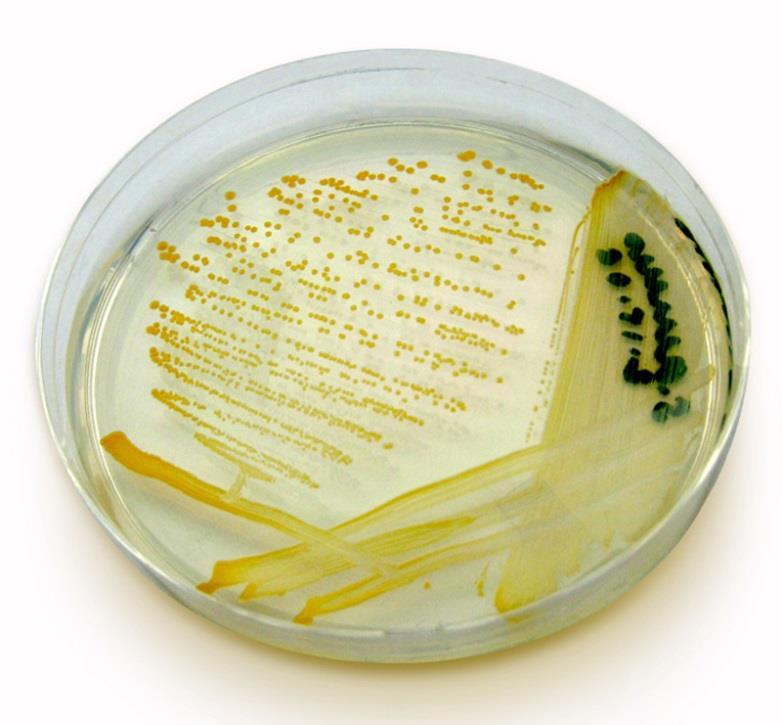 TSYEA/TSA Univerzální kultivační média trypton-sójový agar s kvasničným extraktem (Tryptone Soya Yeast Extract Agar) - pepton z