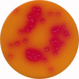Salmonella BG agar Salmonella enteritidis NCTC 5188 Brilliant-green agar BGA (Agar s briliantovou zelení, fenolovou červení a laktózou) Složení média (l): pepton z masa 7 g; NaCl 5 g; laktóza 15 g;