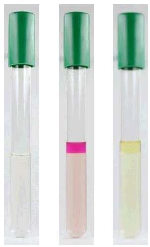 Biochemická konfirmace Salmonella spp. Test na tvorbu indolu - detekce štěpení tryptofanu na indol Složení g/l Trypton 10.00 L-Tryptofan 1.00 Chlorid sodný 5.00 Výsledné ph 7.5 ± 0.