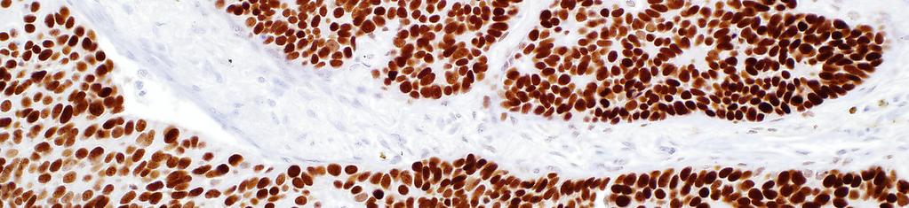 Rev. 0.0 SOX-2 (SP76) Rabbit Monoclonal Antibody DOSTUPNOST PŘÍPRAVKU Kat. Č.