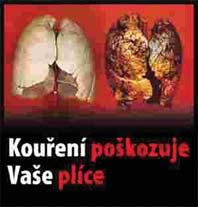 Nekuřáctví základní podmínka zdravých plic s chronickými respiračními nemocemi. Kuřák, který chce, ale není schopen přestat kouřit, často alespoň své kouření omezuje.