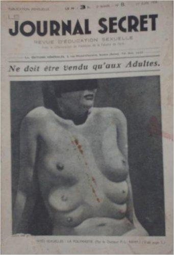 Přílohy: Obr. č. 1. Mléčná lišta (http://eportal.chirurgie.upol.