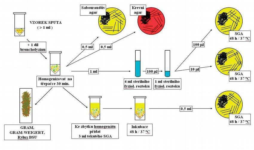 Postup zpracování sputa v mykologické laboratoři http://zdravi.e15.