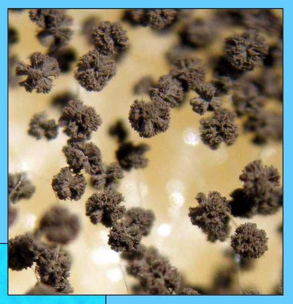 téměř kulovité, černé, nepravidelně bradavčité, 3,5-5 µm v