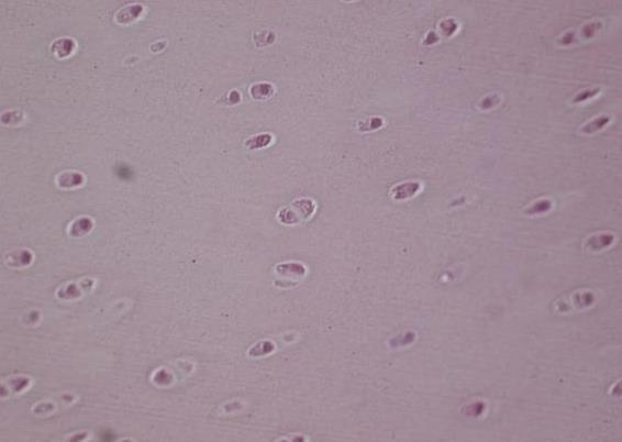 Vazivo Pojivo s převahou organické složky v mezibuněčné hmotě měkké, pružné, ohebné. Mezibuněčnou hmotu vytvářejí svou činností aktivní buňky vaziva fibroblasty.