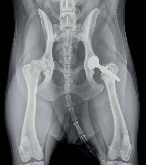 Obr. 22 RTG pacient 1: 20 měsíců po implantaci bez náznaku uvolnění Celkově bylo závažných komplikací s nutností reoperace v našem souboru pacientů 28 %, jedná se ovšem o velice malou a statisticky