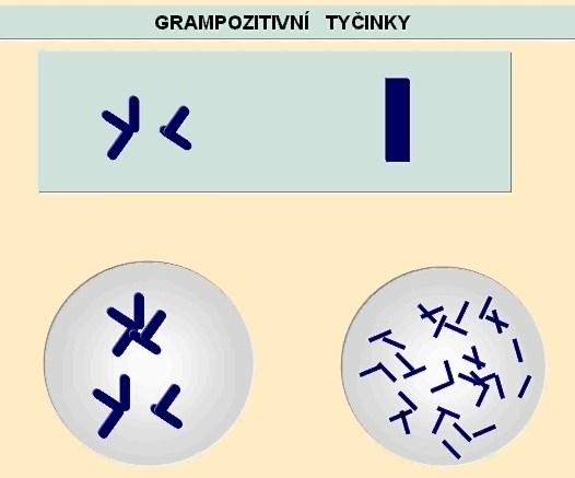 Barvení podle Grama G - -krystalová