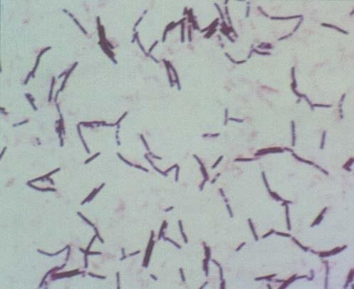 -(glykolipidy)