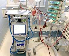 4 AKTUALITY 5 FN BRNO POSKYTUJE EXTRAKORPORÁLNÍ MEMBRÁNOVOU OXYGENACI (ECMO) Od března 2018 se Fakultní nemocnice Brno opět zařadila mezi několik center v České republice, která poskytují