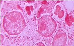 Trichomonas vaginalis Gram Obrázek převzat z CD-ROM Parasite- Tutor
