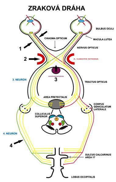 1.2 Zraková dráha Primární zraková dráha První neuron představují světločivé buňky v sítnici, druhý neuron bipolární buňky a třetí neuron gangliové buňky.