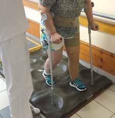 STOJ A CHÔDZA BEZ PROTÉZY Pacient sa s pomocou fyzioterapeuta postupne pripravuje na stoj.