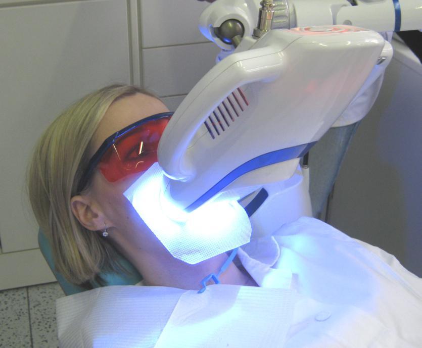 Obr. 13. Bělení pomocí lampy Polus Whitening Accelerator, Beyond TM, USA 6.2 Bělení devitalizovaných zubů Devitalizované zuby jsou zuby s odumřelou a odstraněnou pulpou.
