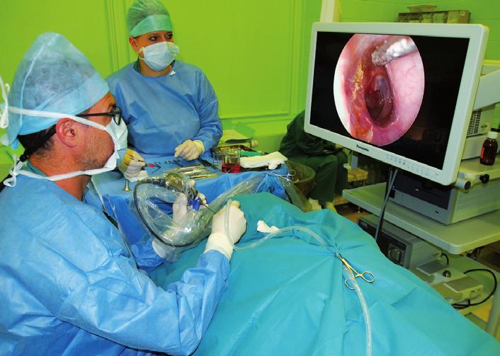 Defi nice, základní pojmy Endoskopická chirurgie ucha (endoscopic ear surgery EES) využívá rigidní otoendoskop k zobrazení struktur zevního zvukovodu, středního a vnitřního ucha při kofochirurgických
